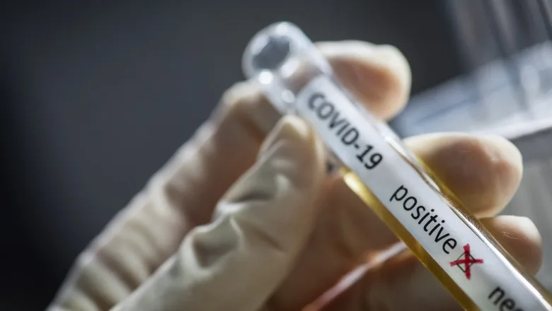 MAE: Încă un angajat din Centrala Ministerului Afacerilor Externe a fost confirmat cu noul coronavirus