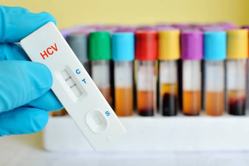 Diagnostic timpuriu pentru hepatită: testare gratuită, inclusiv pentru persoanele neasigurate