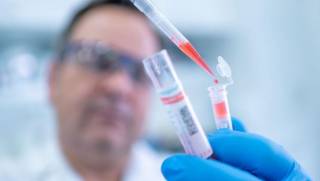 Persoane confirmate pozitiv cu COVID – 19 la Spitalele militare din Focșani și Galați